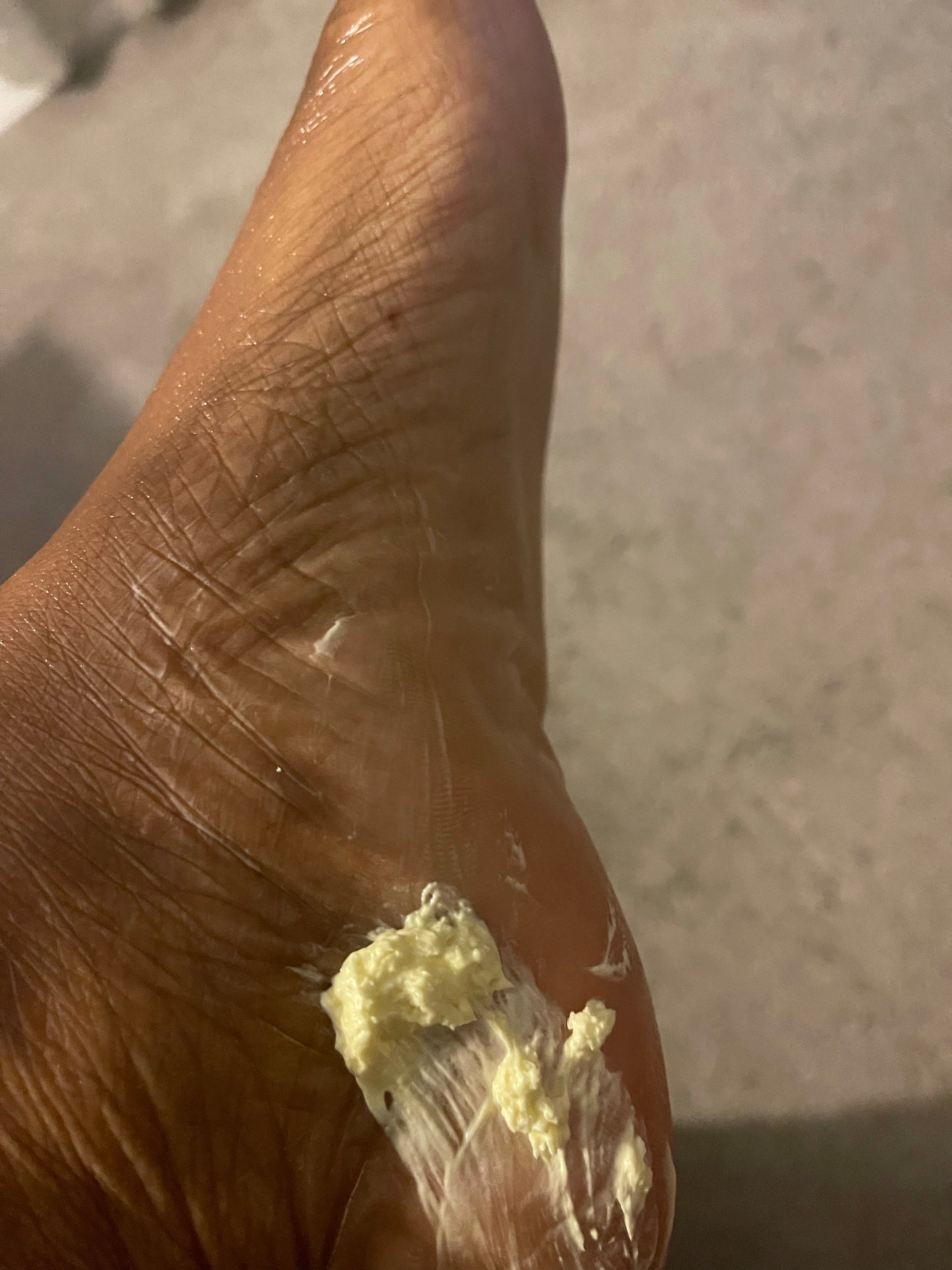 Amazing Foot Care Kit